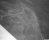 Aerial of Highway Construction
