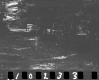 Wyman Property, Forest View